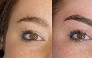 microblading, sopracciglia, centro estetico olgiata Beauty 20.12